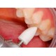COMPOSITE POLISHING KIT